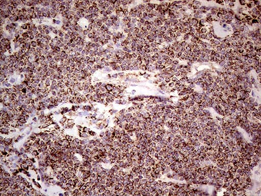 SHMT / SHMT2 Antibody (clone OTI1E12)
