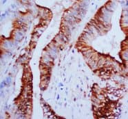 ERK1 + ERK2 Antibody (N-Terminus)