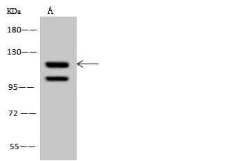 RBL1 / p107 Antibody