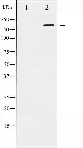 ERBB2 / HER2 Antibody (phospho-Tyr1248)