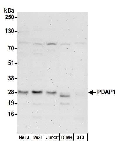 Polyclonal Rabbit anti-Human PDAP1 Antibody (aa75-100, WB)
