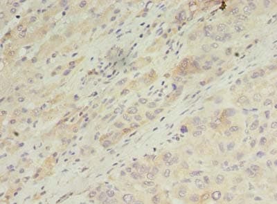 ARL14 Antibody