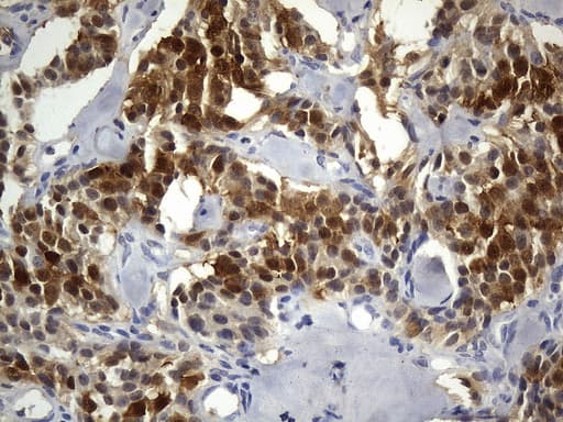 Monoclonal Mouse anti-Human UCHL1 / PGP9.5 Antibody (clone UMAB244, Carrier-free, IHC, WB)