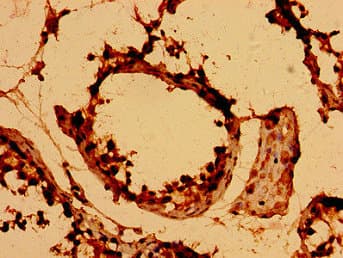 Polyclonal Rabbit anti-Human DEFB126 Antibody (IHC)