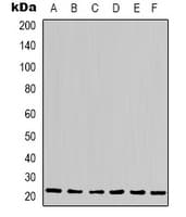 Monoclonal Mouse anti-Human PPIB / Cyclophilin B Antibody (IHC, WB)