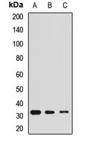 PathPlus™ Polyclonal Rabbit anti-Human CALB2 / Calretinin Antibody (IHC, WB)