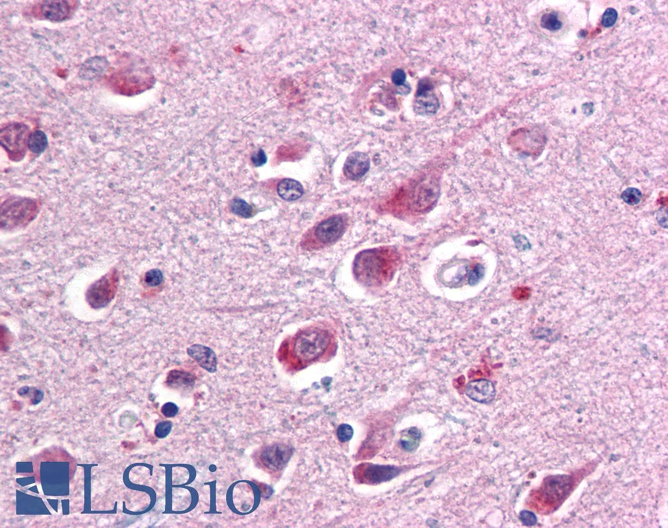 IHC-plus™ SARM1 / SARM Antibody (clone Sarmy-1)