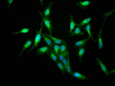 S100A9 / MRP14 Antibody