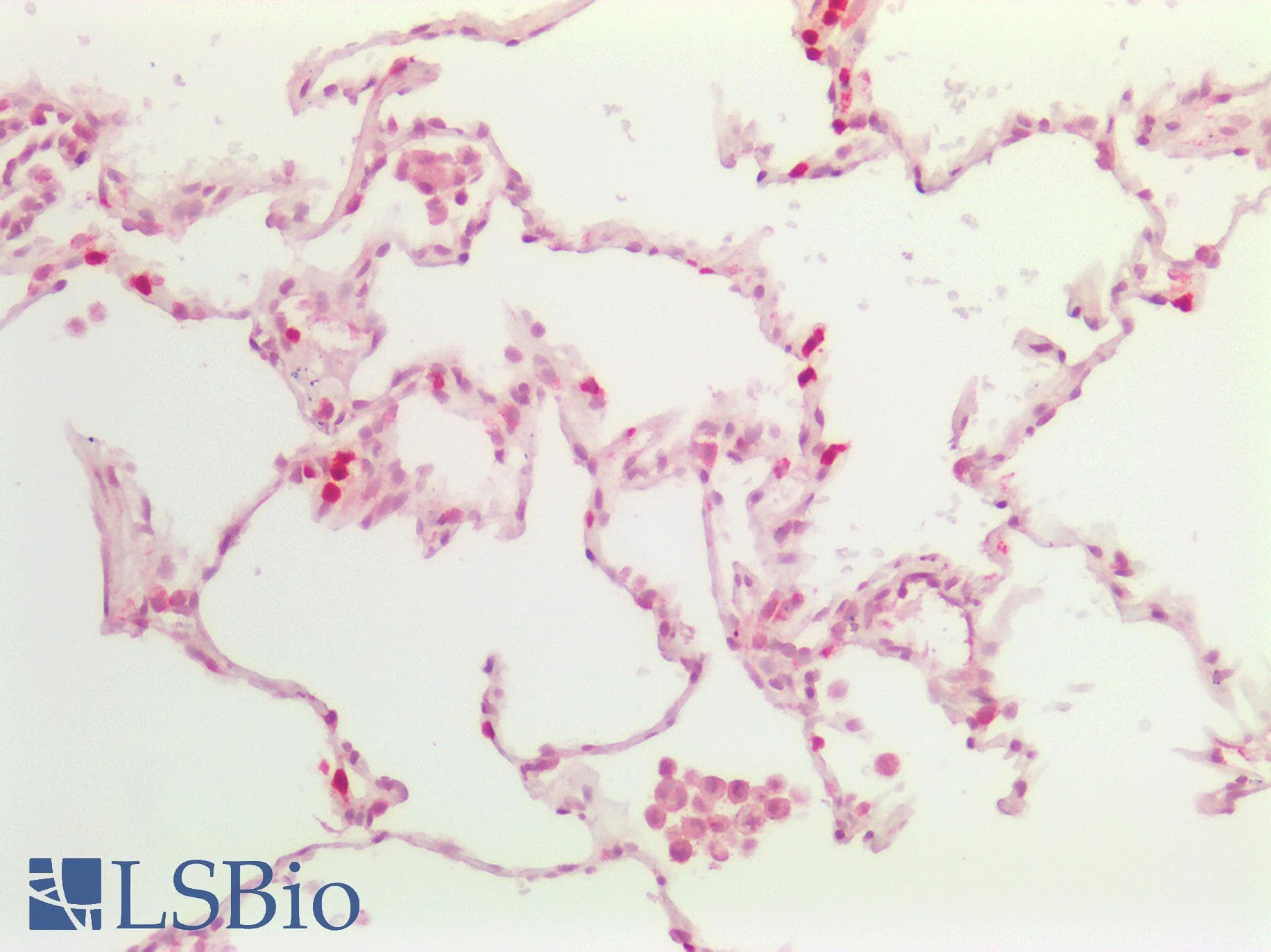 PathPlus™ EIF4EBP1 / 4EBP1 Antibody (aa35-84)