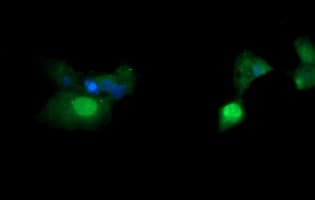 IHC-plus™ ERG Antibody (clone 2G8)