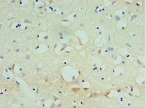 SPAG16 Antibody (aa1-183)