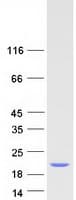 Human SF3B1 Protein (Recombinant Myc-DDK (Flag))