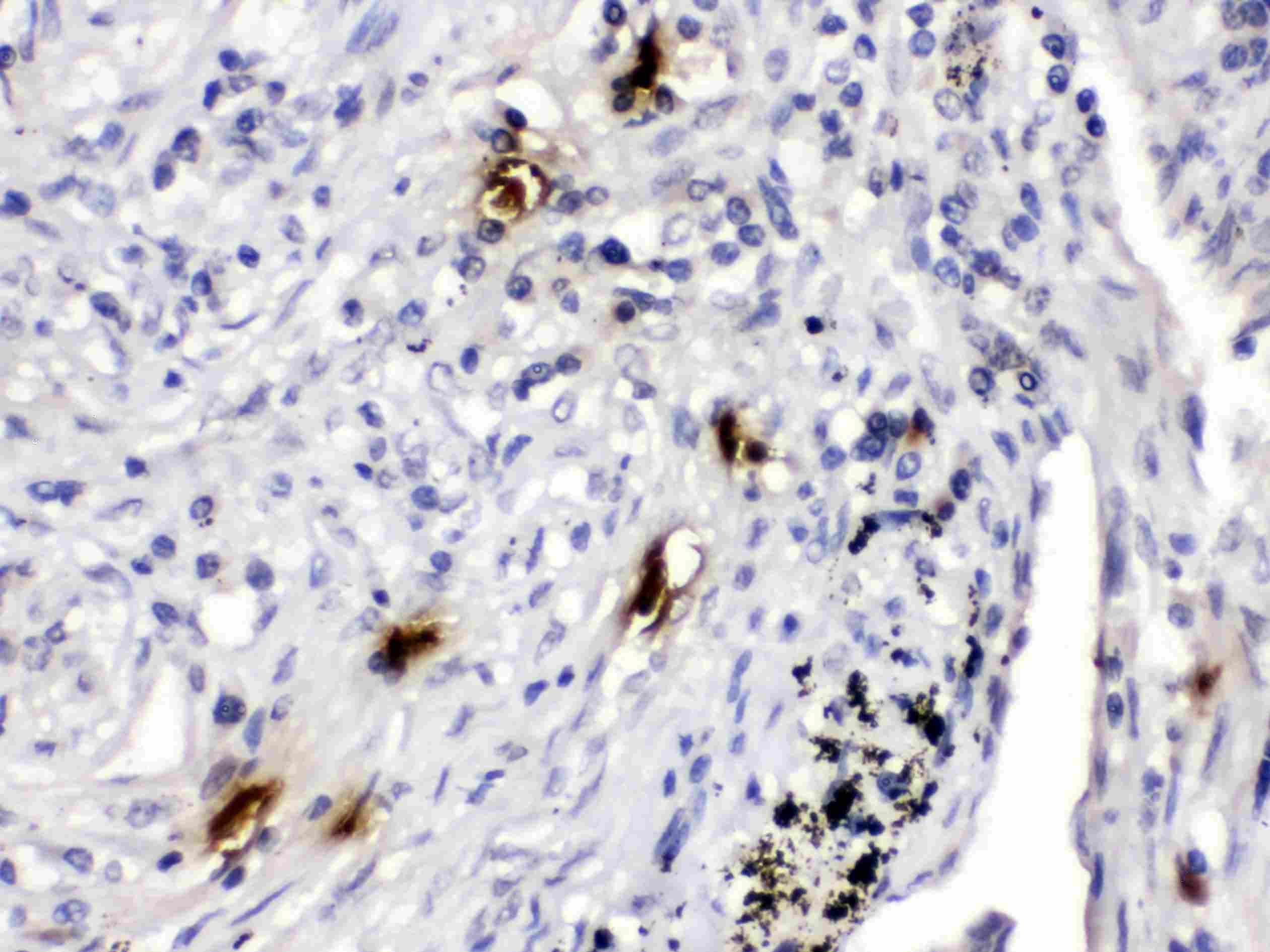 Polyclonal Rabbit anti-Human TPSAB1 / Mast Cell Tryptase Antibody (IHC, WB)