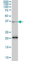 SRSF10 / FUSIP1 Antibody (clone 1A6)