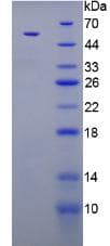 PTH / Parathyroid Hormone Protein (Recombinant His-MBP)