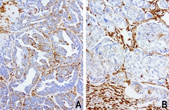 Vimentin Antibody (aa210-466, clone UMAB159)