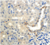 SCNN1A / ENaC Alpha Antibody (clone 7B8)