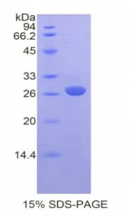 Mouse SLC27A5 / BACS Protein (Recombinant His)