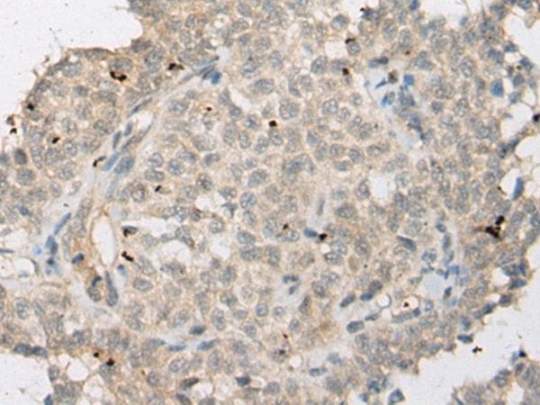 ZNF449 Antibody