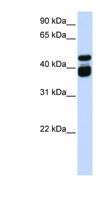 TBX6 Antibody (aa360-409)