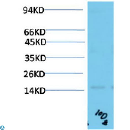 TTR / Transthyretin Antibody
