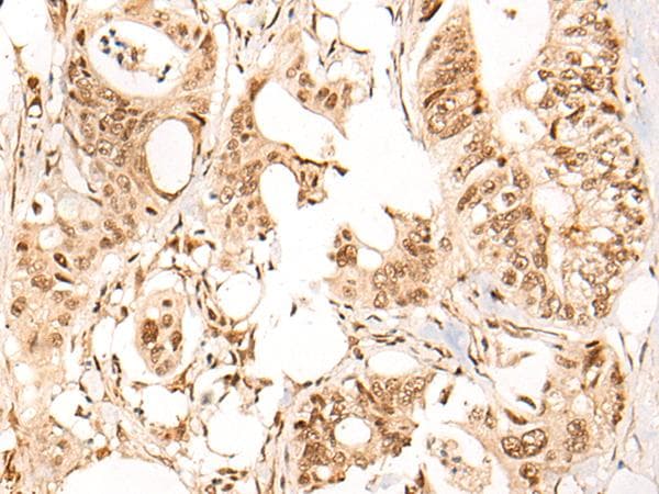 ARID1B / BAF250B Antibody