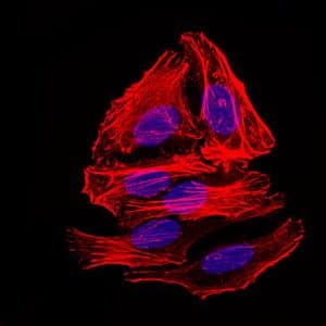 Monoclonal Mouse anti-Human BPIFA2 / SPLUNC2 Antibody (clone 1F12, IHC, WB)