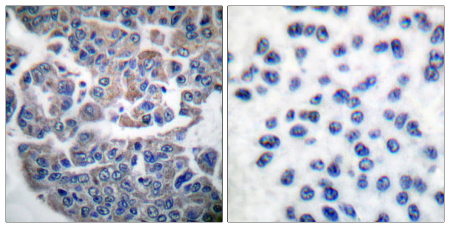 EEF2K Antibody (phospho-Ser366)