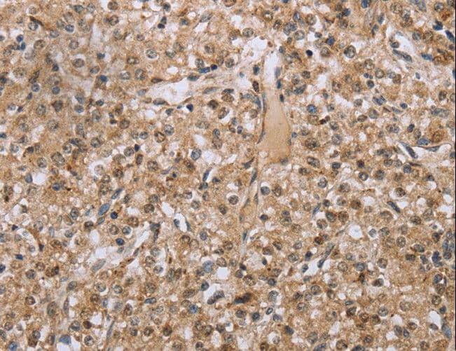 RAB39B Antibody