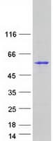 Human PMPCA Protein (Recombinant Myc-DDK (Flag))