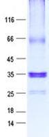 Human LYPD1 Protein (Recombinant GST, N-terminus + His, C-terminus)