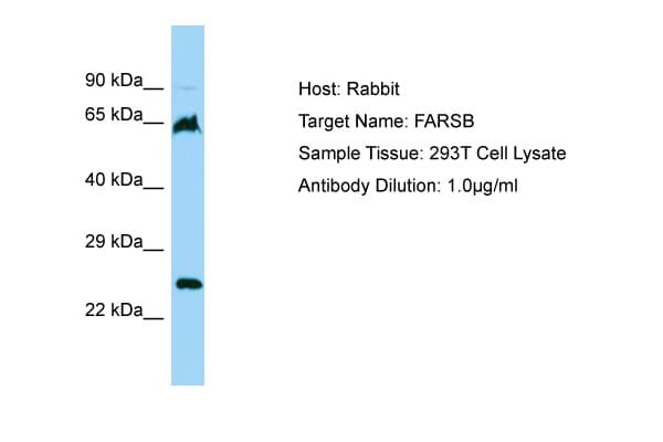 FARSB Antibody (aa22-71)