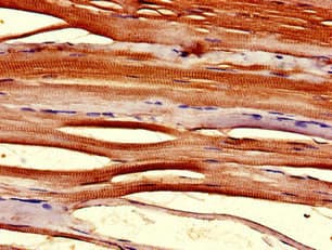 TMX2 / TXNDC14 Antibody