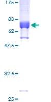 Human PDEF / SPDEF Protein (Recombinant GST)
