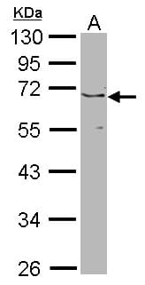 JMJD6 / PSR Antibody (aa1-234)