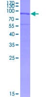 Human FBLN5 / Fibulin 5 Protein (Recombinant GST)