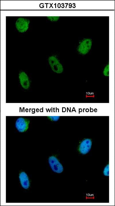 L3MBTL1 Antibody (aa365-723)