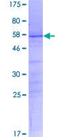 Human KLF16 Protein (Recombinant GST)