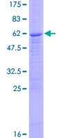 Human PPT1 / CLN1 Protein (Recombinant GST)