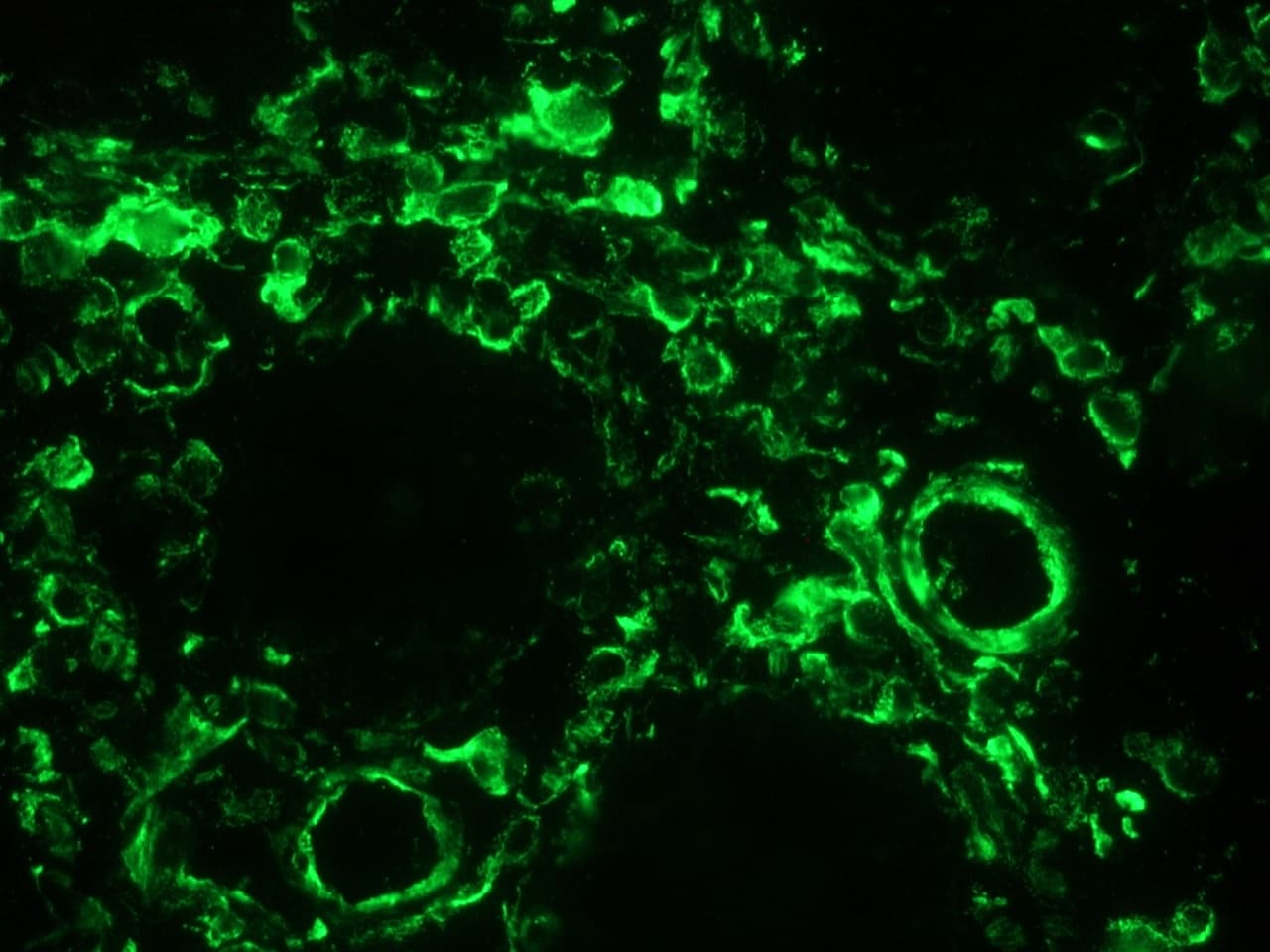 PathPlus™ Vimentin Antibody (clone RV202)