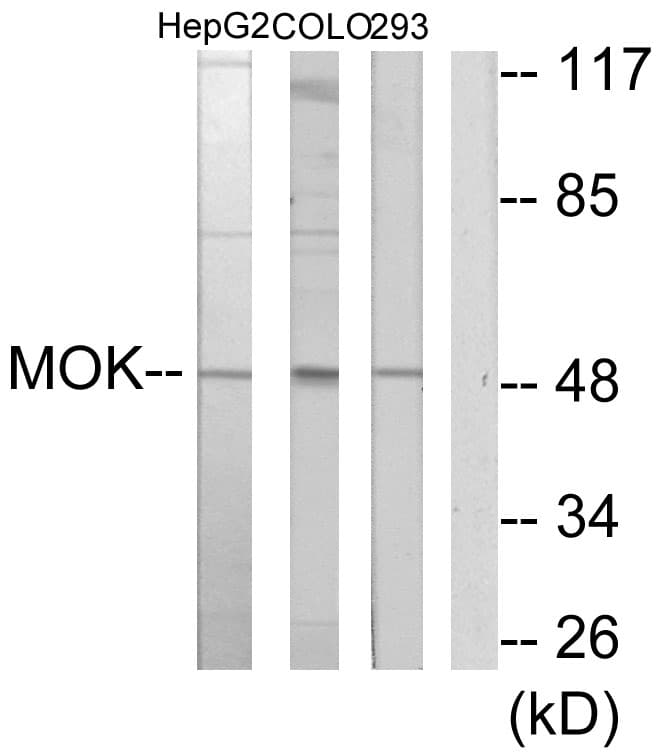 Polyclonal Rabbit anti-Human MOK / RAGE Antibody (aa261-310, IHC, WB)