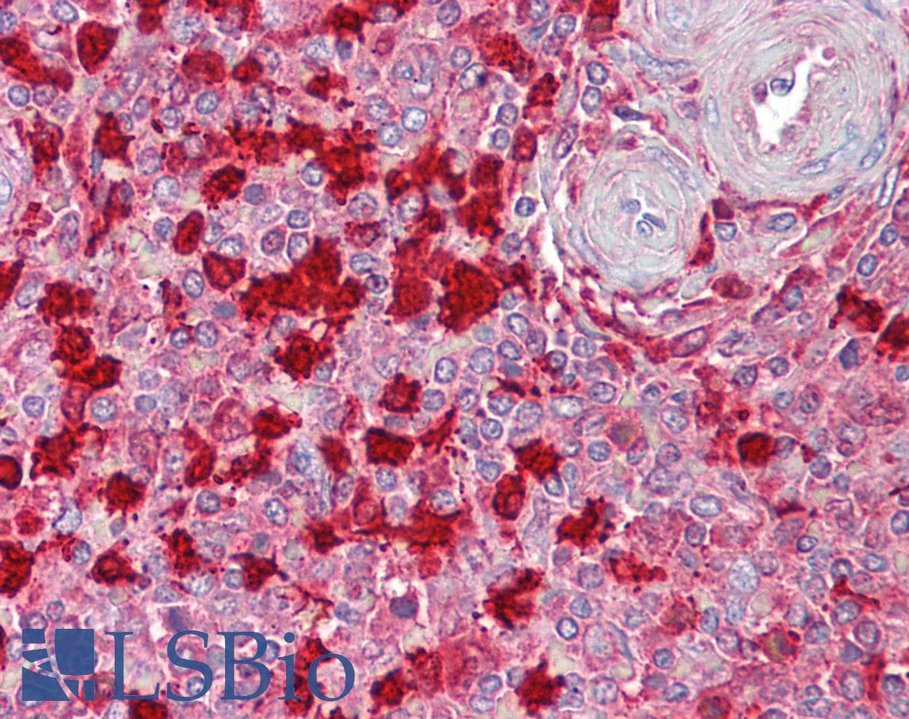 PathPlus™ S100A9 / MRP14 Antibody (C-Terminus)