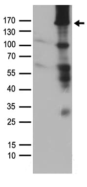 MAP3K5 / ASK1 Antibody