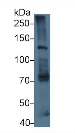 LAMB3 / Laminin Beta 3 Antibody (aa595-778)