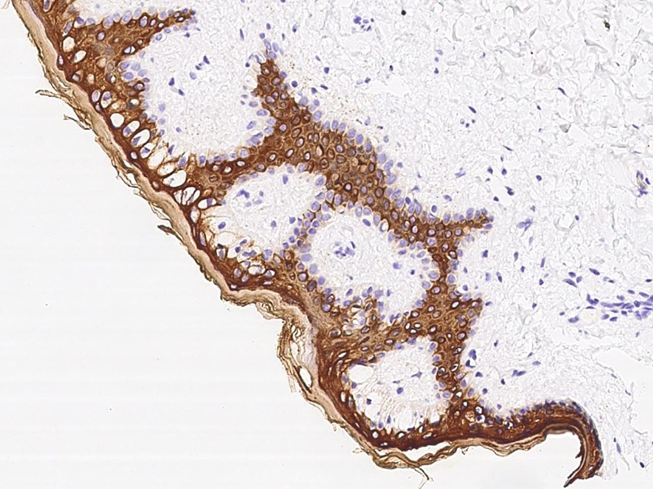 KRT10 / CK10 / Cytokeratin 10 Antibody