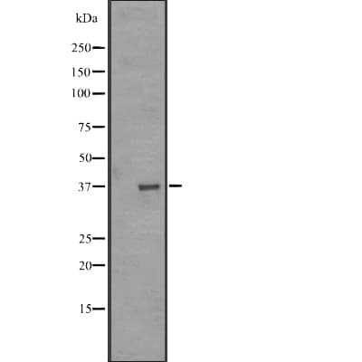 Olfactory Receptor, Family 51, Subfamily A, Member 1 Pseudogene (OR51A1P) Antibody