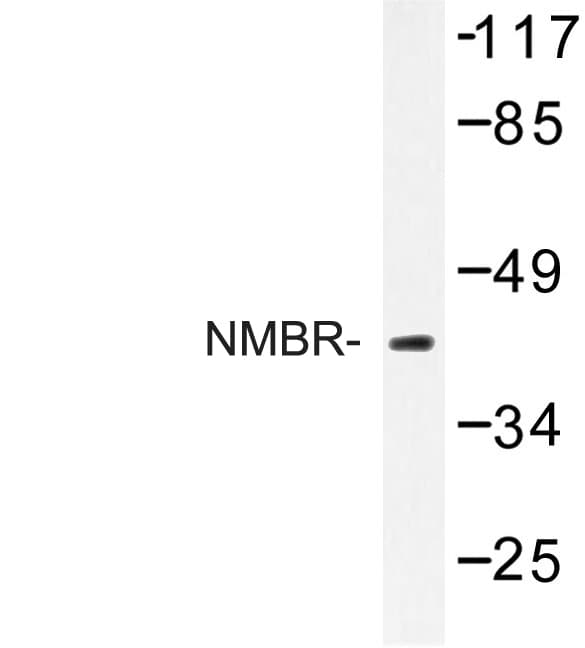 NMBR Antibody (Leu264)