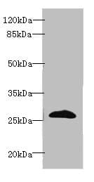 EFNA3 / Ephrin A3 Antibody (aa23-214)
