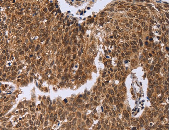 ERCC6L / FLJ20105 Antibody
