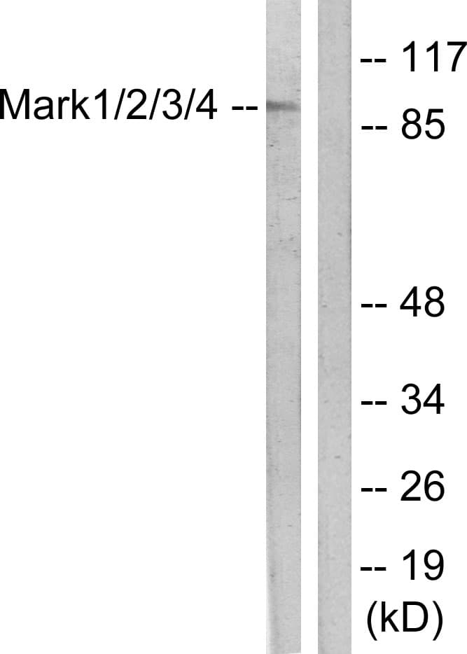IHC-plus™ Polyclonal Rabbit anti-Human MARK1+2+3+4 Antibody (aa181-230, IHC, IF, WB)